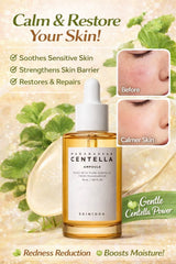 SKIN1004 Madagascar Centella Ampoule